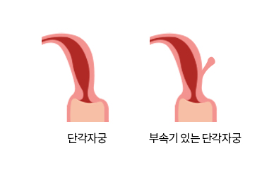 단각자궁